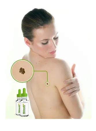 Anatomy One Skin Tag Remover-happy-customer